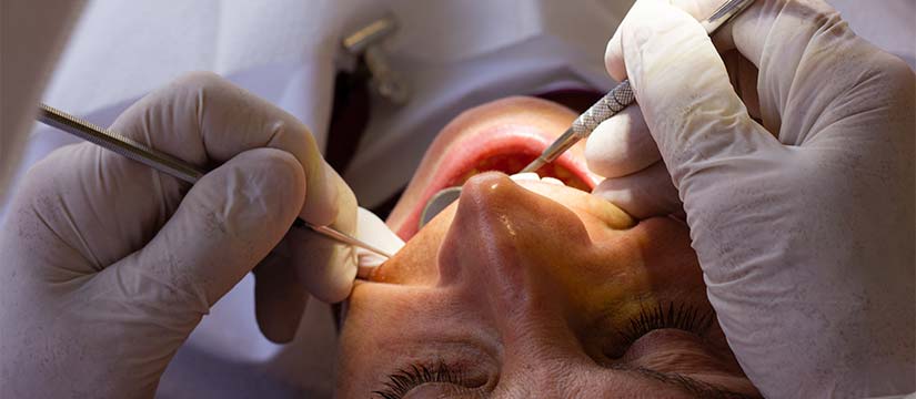 carrall-a-les-dents-clinica-dental-soto-sant-quirze-del-valles