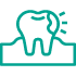caries-dental-soto caries-dental-soto