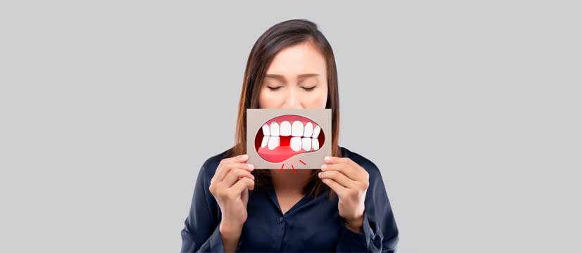 las-diferentes-opciones-de-tratamiento-para-reemplazar-un-diente-perdido-clinica-dental-soto