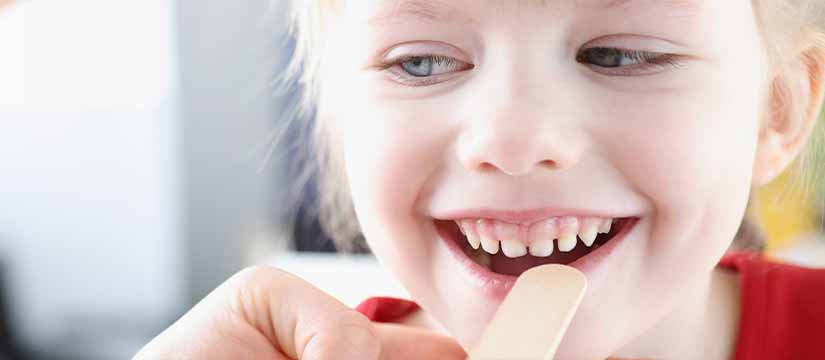 caries-infantil-causas-prevencion-y-tratamientos-esenciales