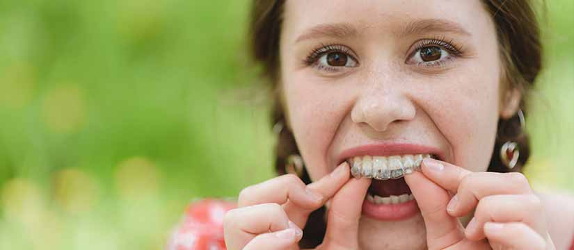 dientes-torcidos-causas-consecuencias-y-soluciones
